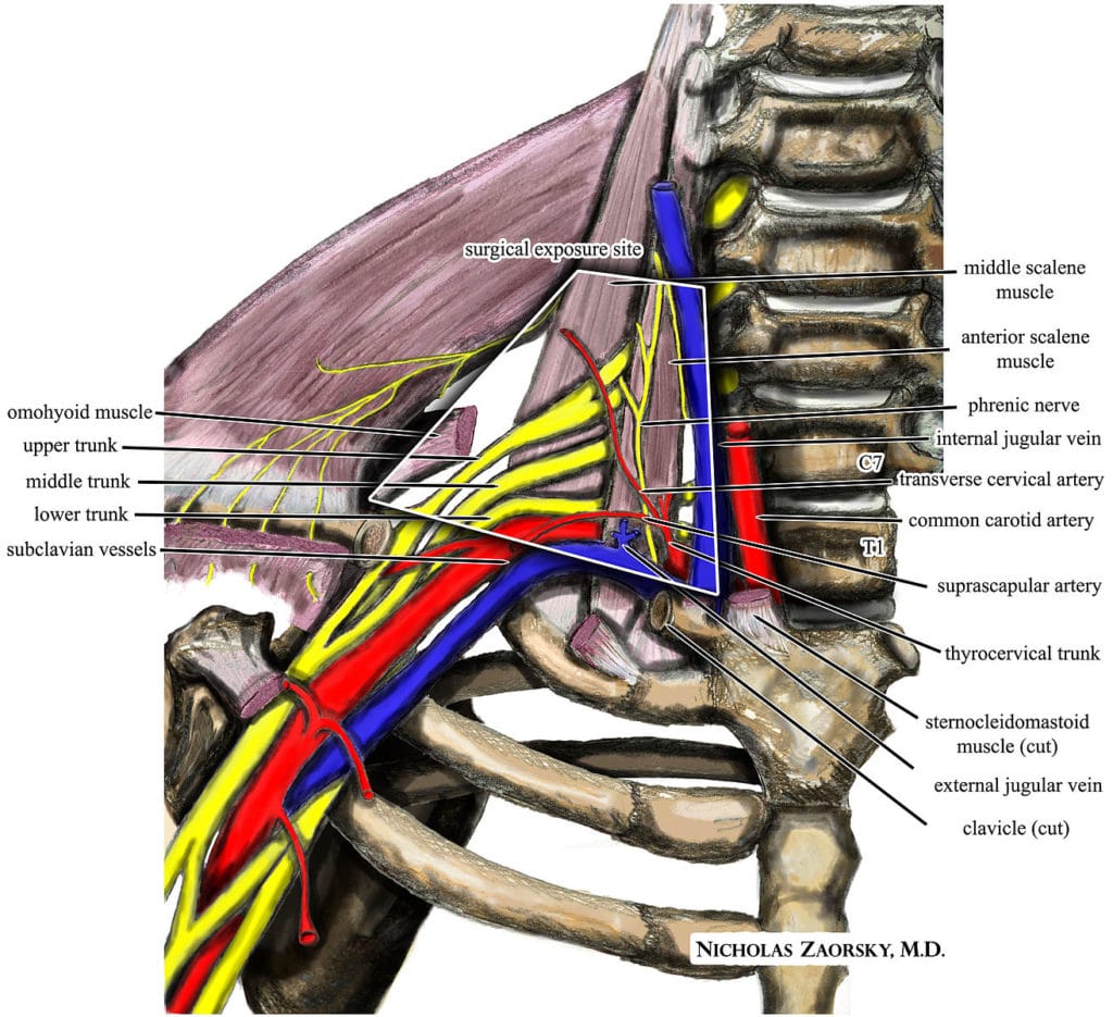 Adson's Test for Thoracic Outlet Syndrome - PHYSICAL THERAPY WEB